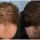 Finasteride Men Here are some results of the use of Finasteride in men.