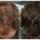 Finasteride Men Here are some results of the use of Finasteride in men.