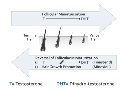 Testosterone medication for men