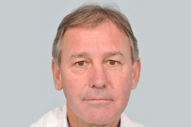 Before-Bryan Robson