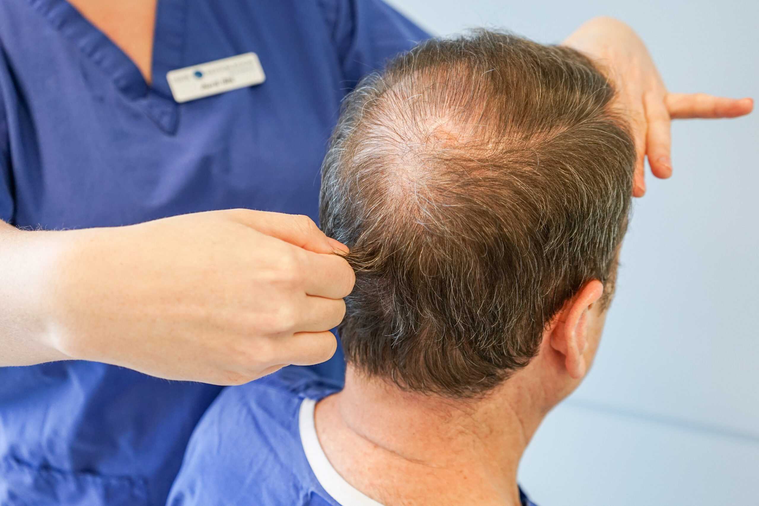 Do Hair Transplants Work - Hair Transplant Clinic Ireland