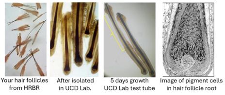 Charles Institute hair follicle research